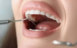 Periodontal Treatment Cost in Woodbridge, VA (2026 Guide)