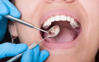 Tooth Extraction Aftercare in Woodbridge, VA