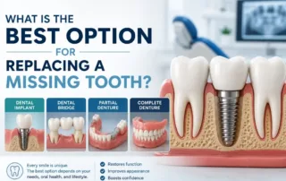 What Is the Best Option for Replacing a Missing Tooth in Virginia?
